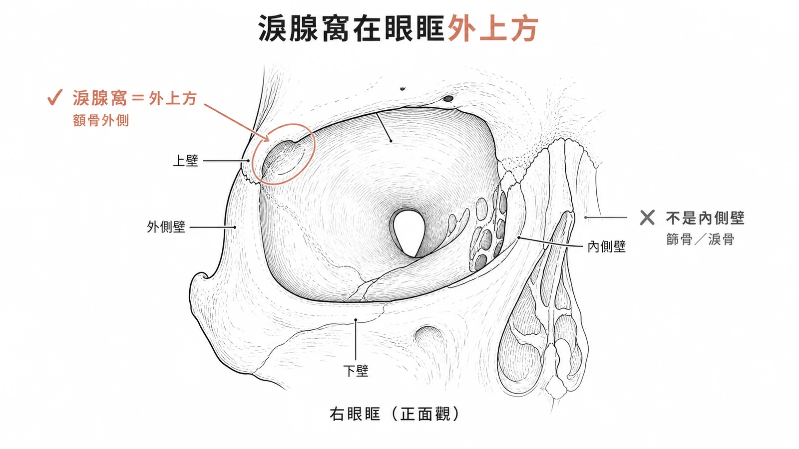 淚腺窩位於眼眶外上方額骨外側,而非內側壁
