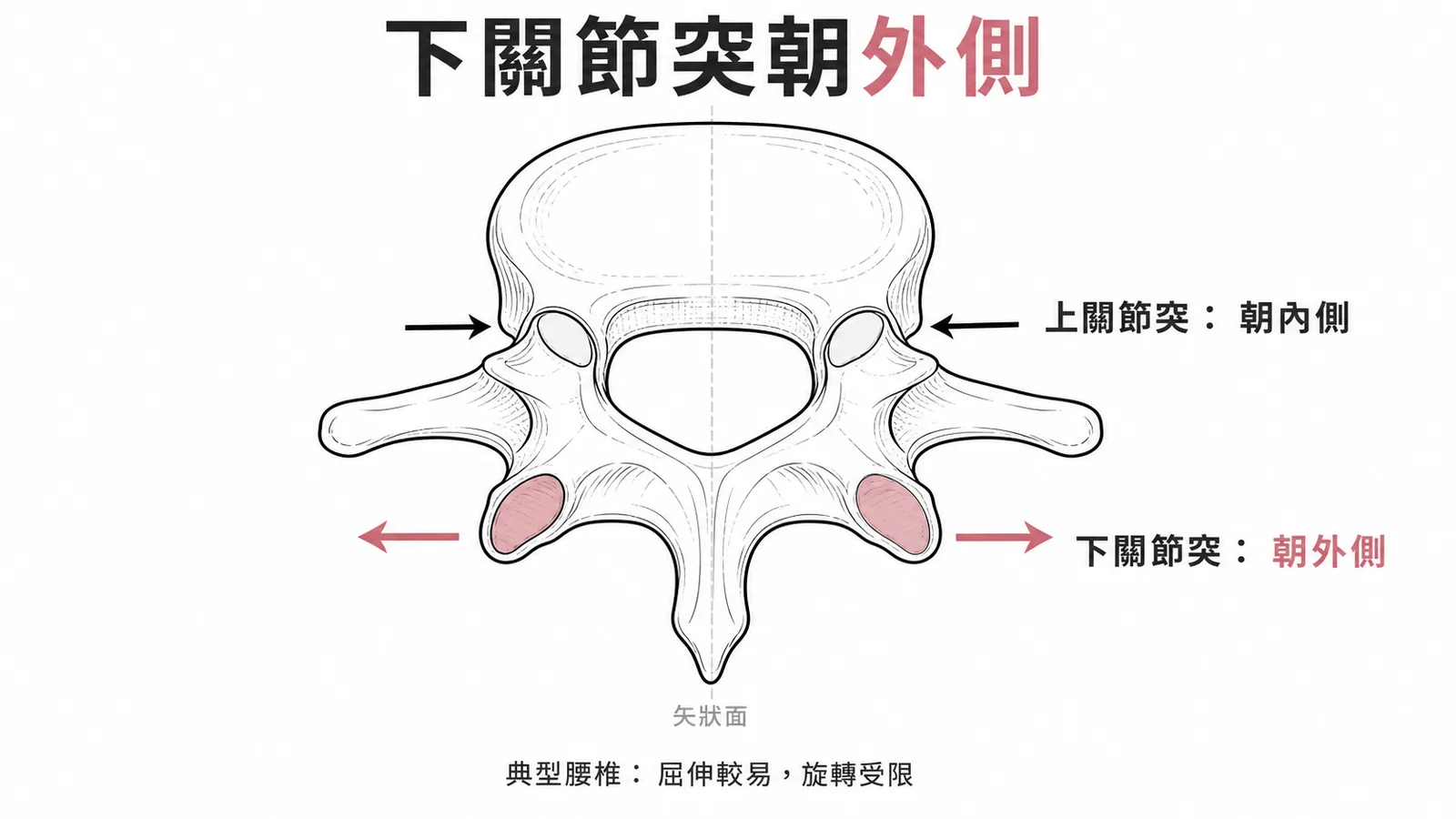 典型腰椎下關節突關節面朝外側、上關節突朝內側