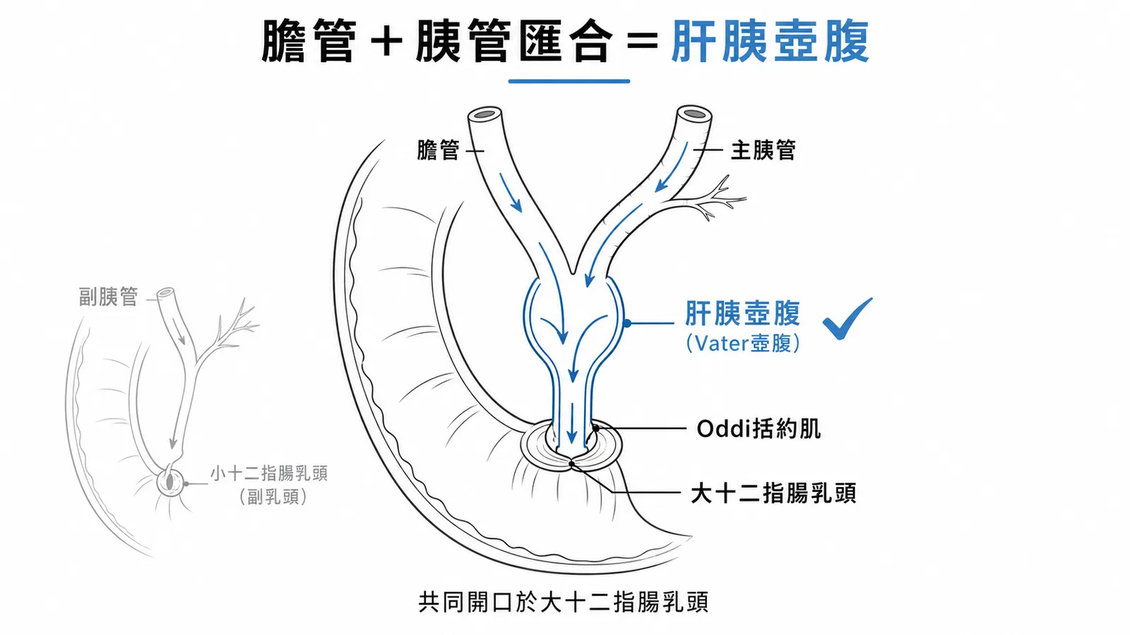 主胰管與膽管匯合成肝胰壺腹Vater壺腹,經Oddi括約肌共同開口於大十二指腸乳頭