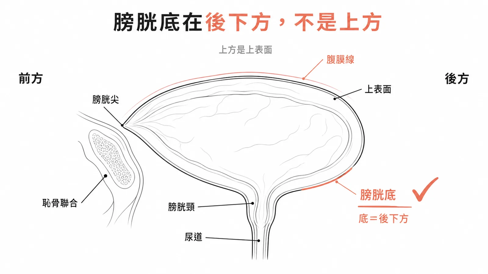 膀胱尖朝前接恥骨聯合、膀胱底位於後下方、膀胱頸在最下方接尿道、上表面被腹膜覆蓋