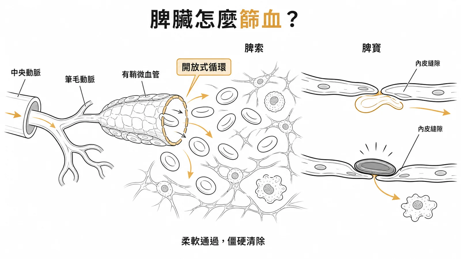 脾臟開放式循環:紅血球需擠過脾竇內皮縫隙、僵硬老舊者被清除