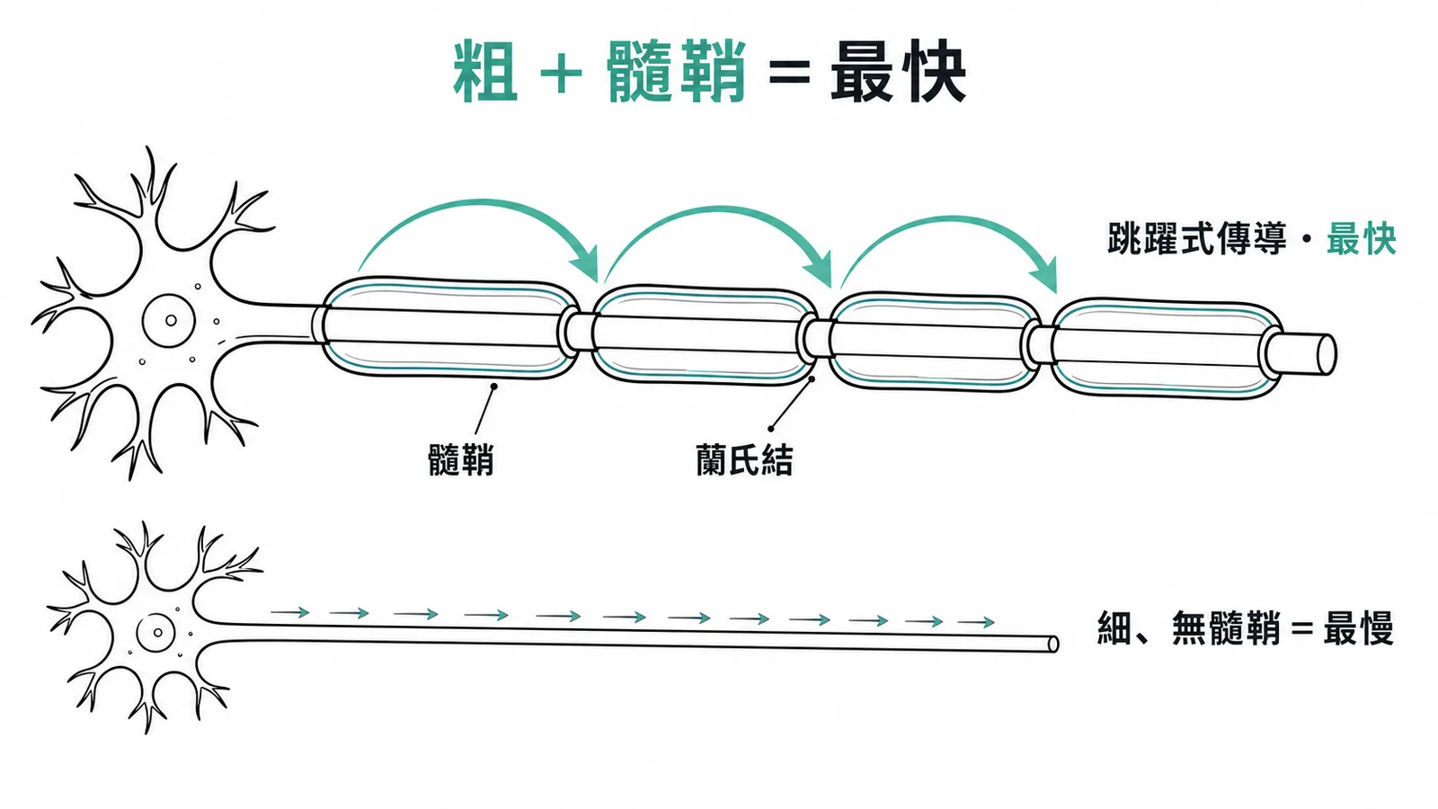 粗且有髓鞘的神經纖維以跳躍式傳導最快、細且無髓鞘最慢