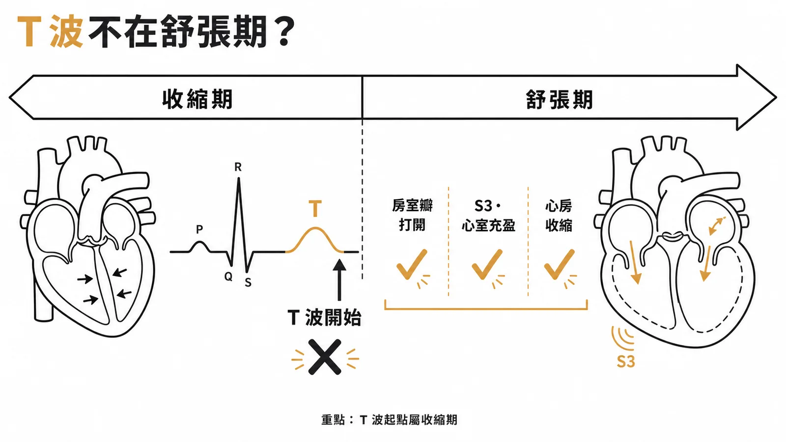 T波起點屬收縮期末;房室瓣打開、S3、心房收縮才是舒張期事件