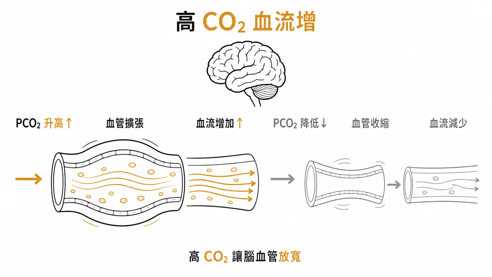 腦動脈PCO₂升高使腦血管擴張、血流增加;PCO₂降低則收縮