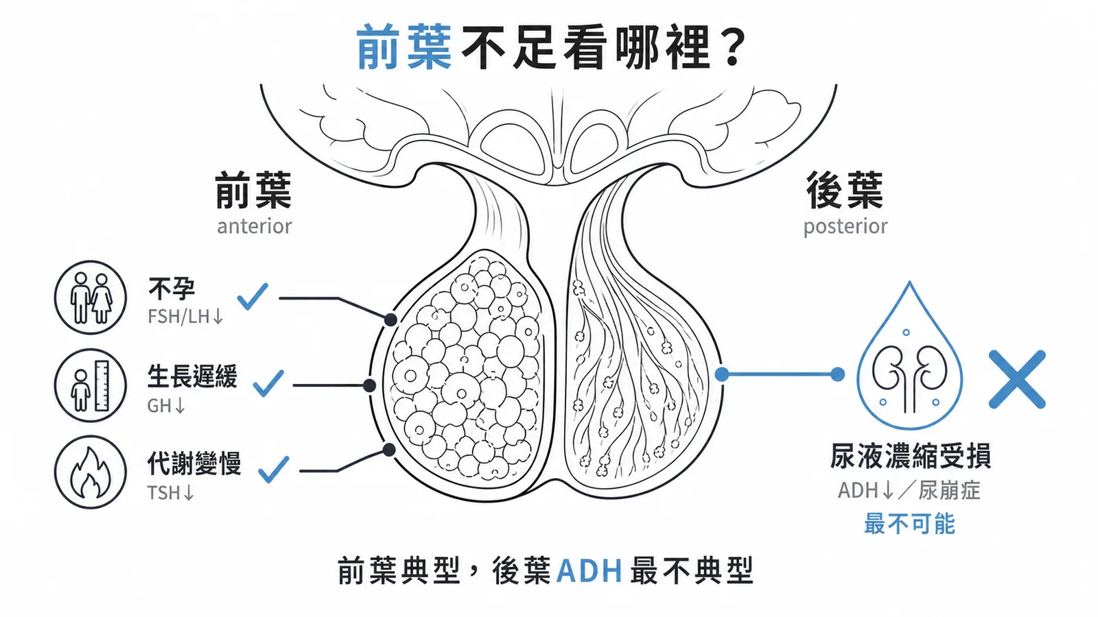 前葉不足致不孕/生長遲緩/代謝變慢;尿液濃縮受損屬後葉ADH、最不可能
