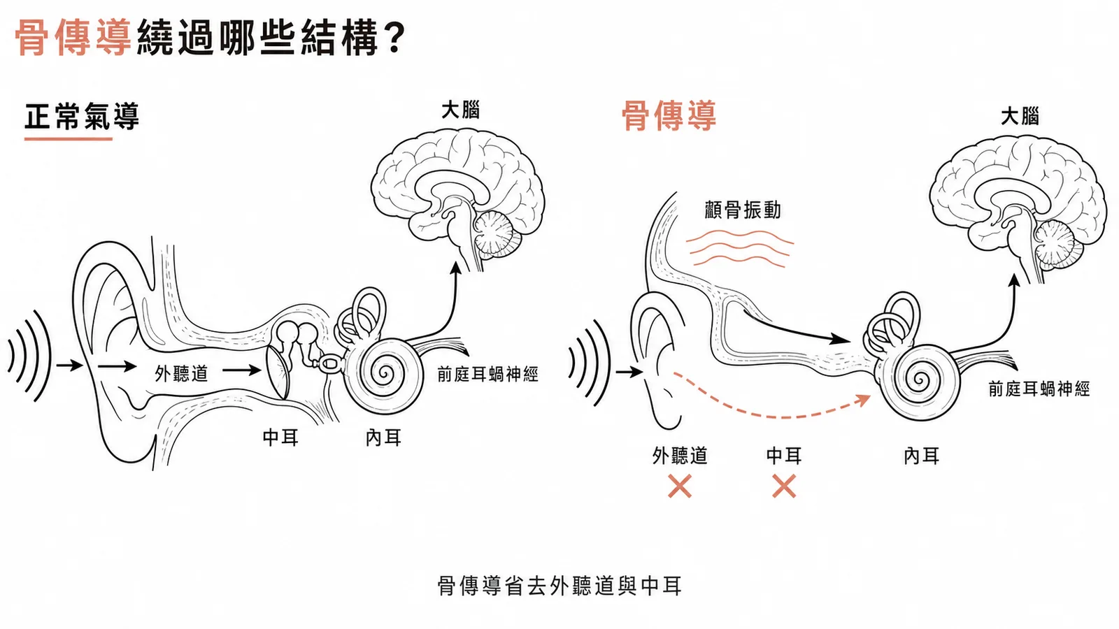 骨傳導耳機繞過外耳中耳直達內耳的路徑