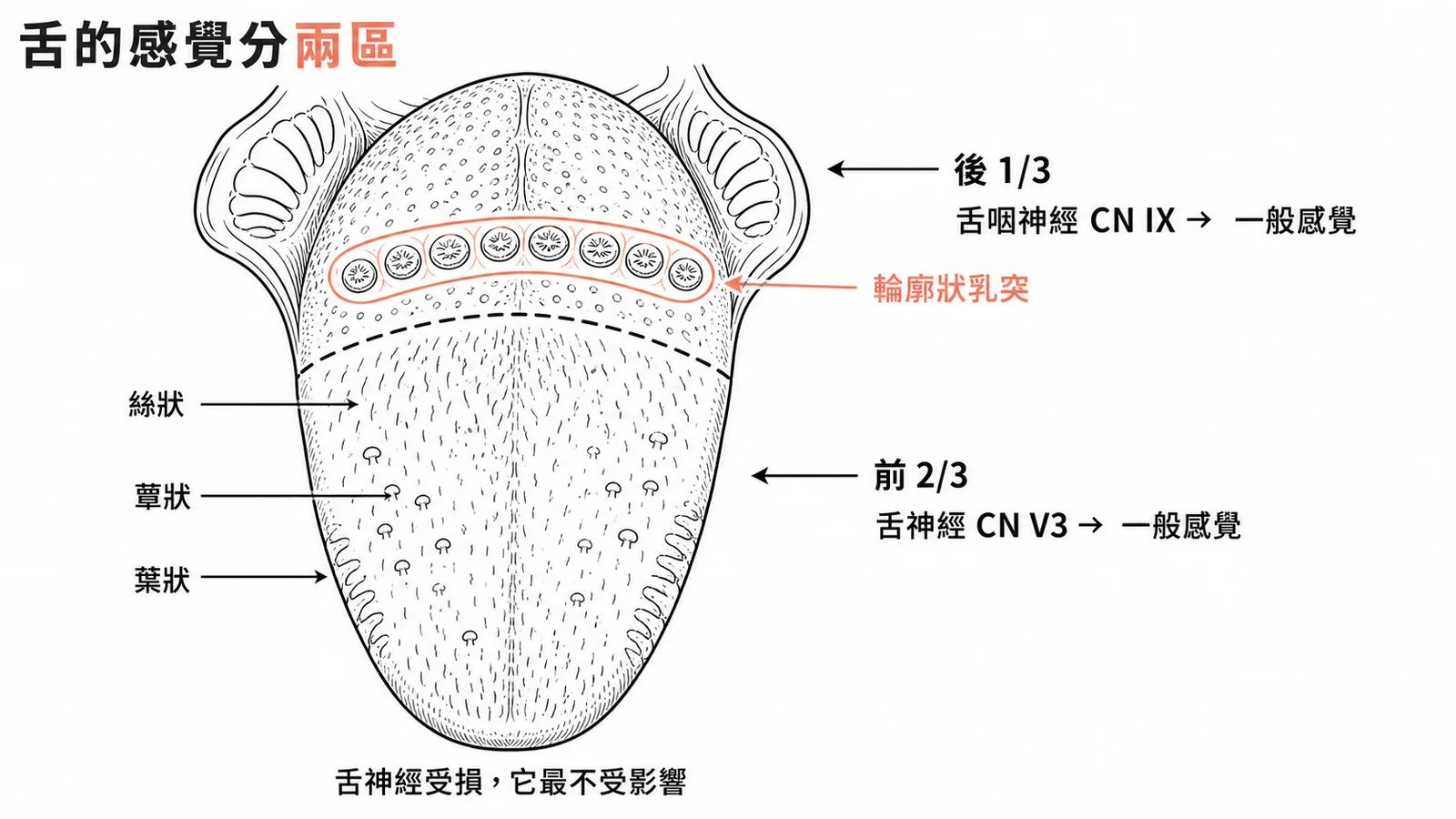 舌神經支配舌前2/3感覺而輪廓狀乳突由舌咽神經支配示意圖