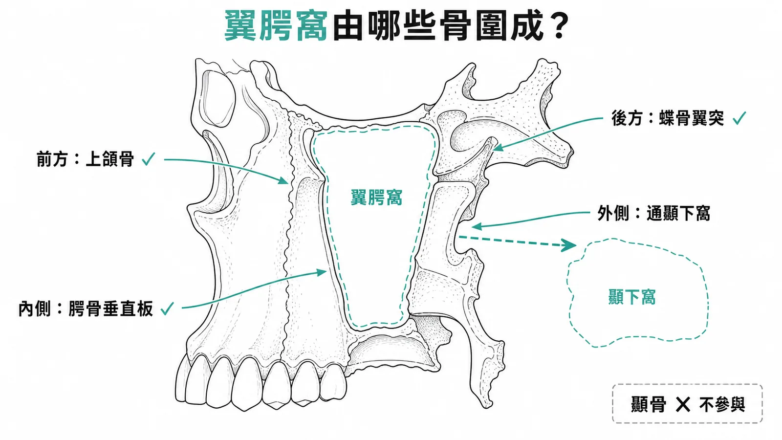 翼腭窩由蝶骨、腭骨、上頷骨圍成而顳骨不參與示意圖