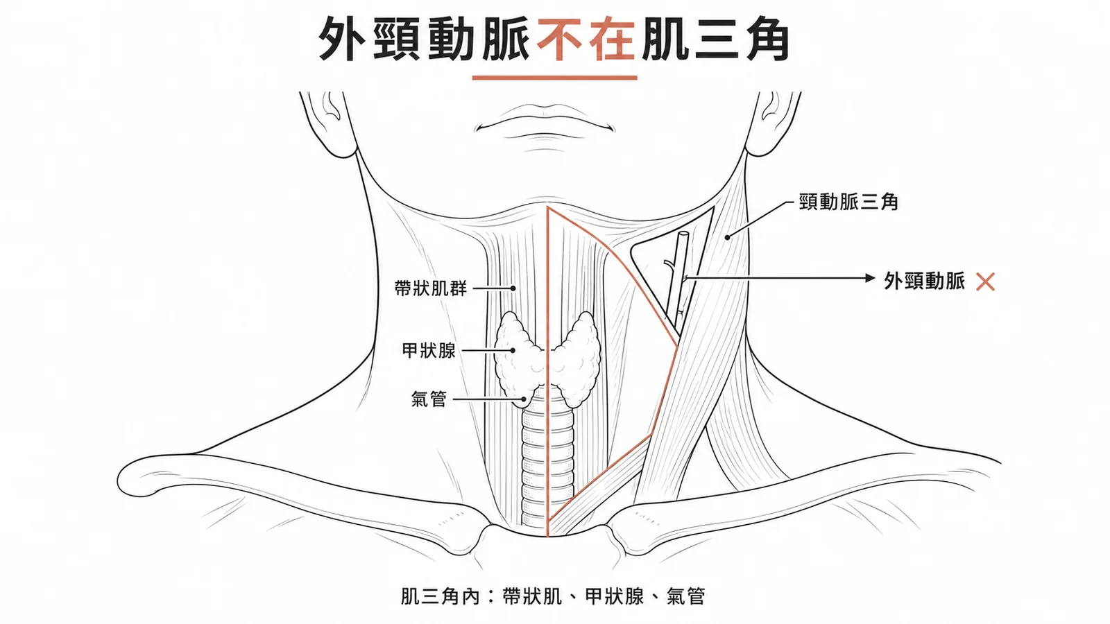 頸部肌三角內容物與外頸動脈位於頸動脈三角對照示意圖