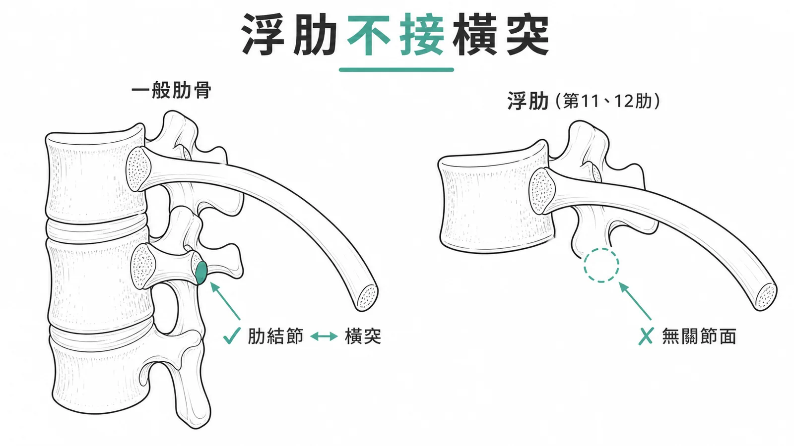 浮肋第11-12肋骨只經肋骨頭與椎體相接不與橫突相接示意圖