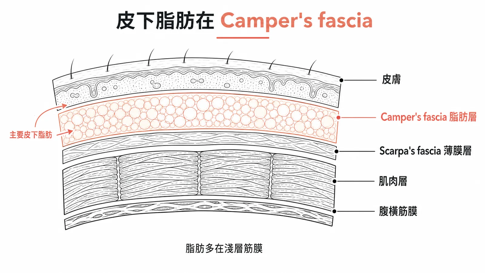 Camper's fascia 是淺筋膜的脂肪層，含主要皮下脂肪