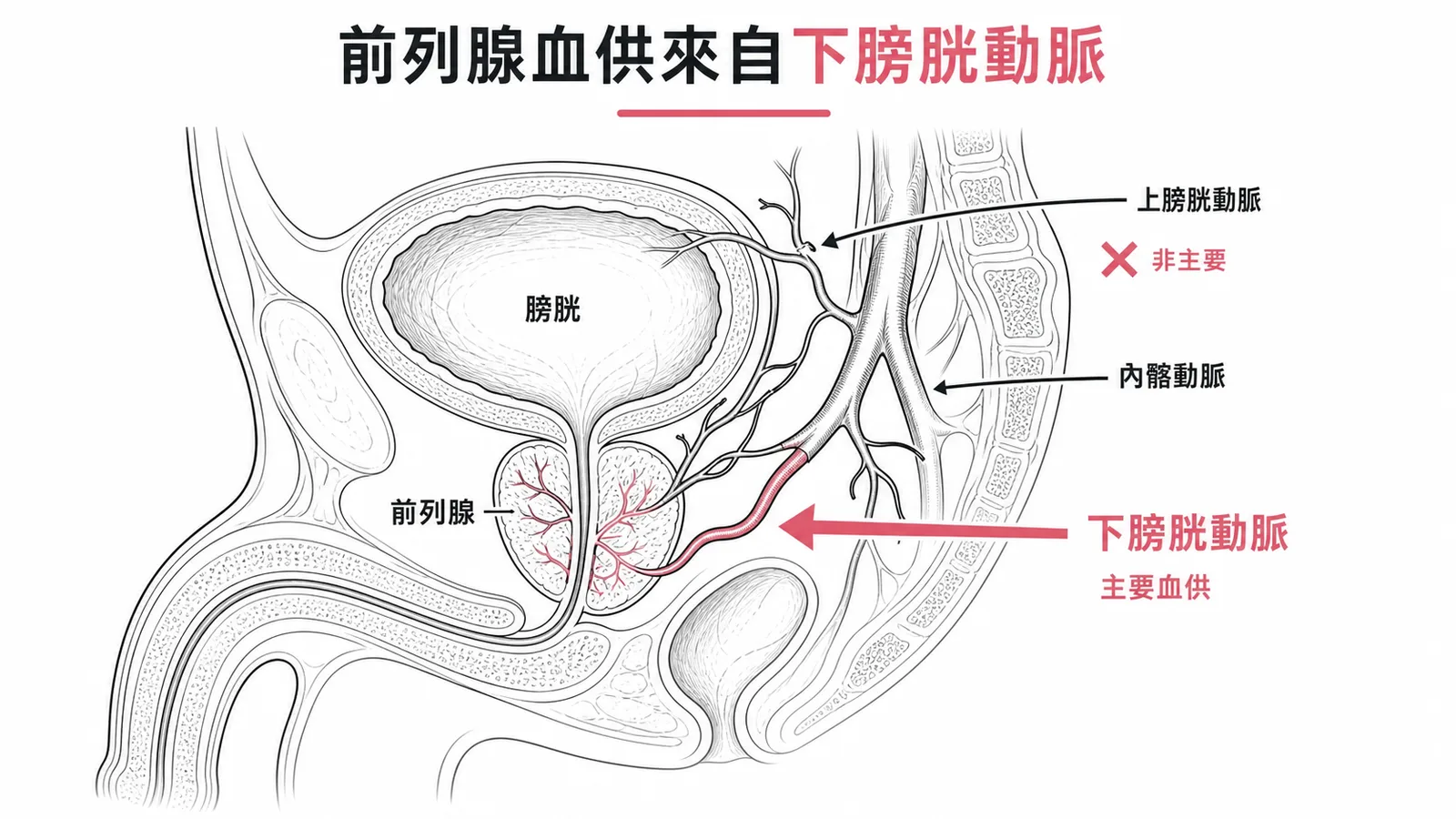 前列腺主要血供來自下膀胱動脈而非上膀胱動脈