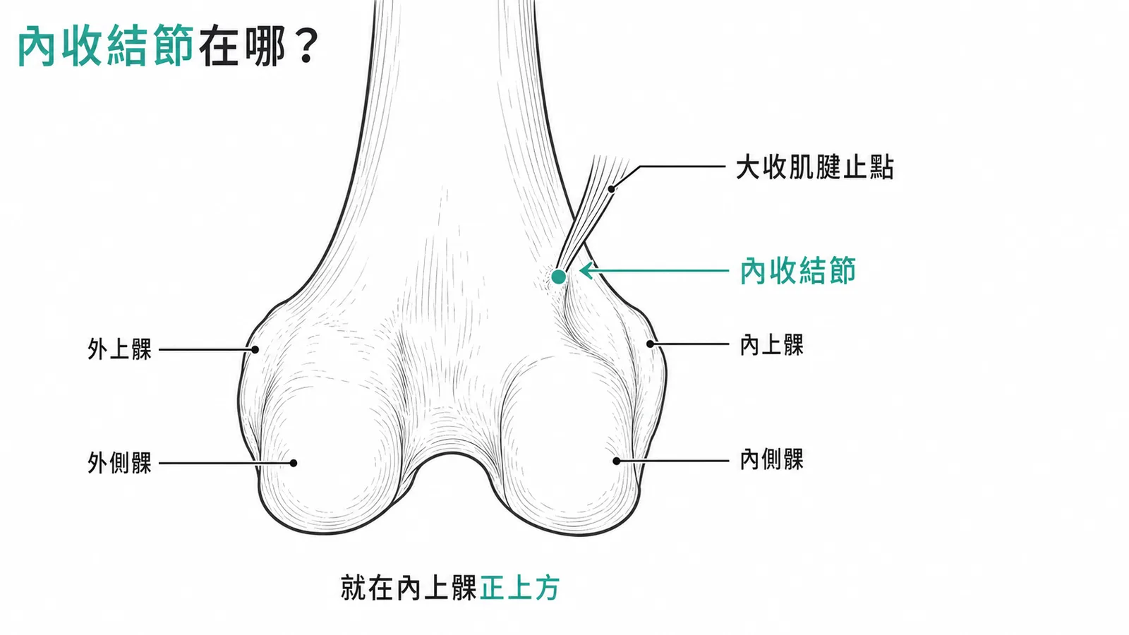 股骨內收結節位於遠端內上髁上方，是大收肌腱止點