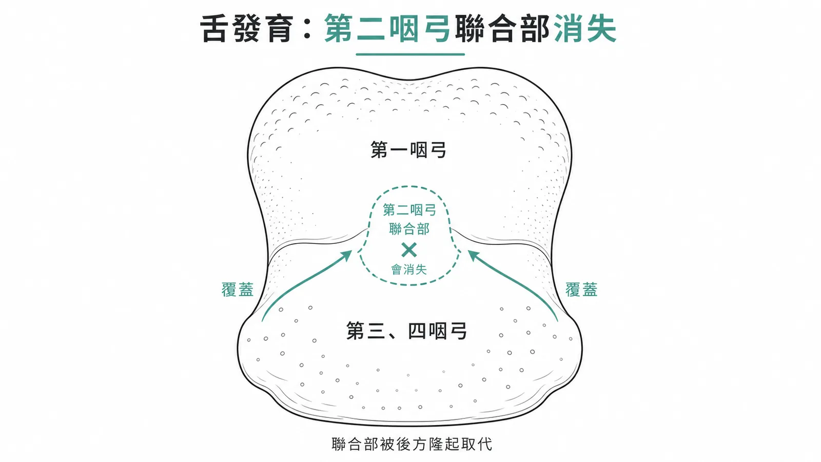 舌發育中第二咽弓形成聯合部但最終被第三四咽弓覆蓋消失