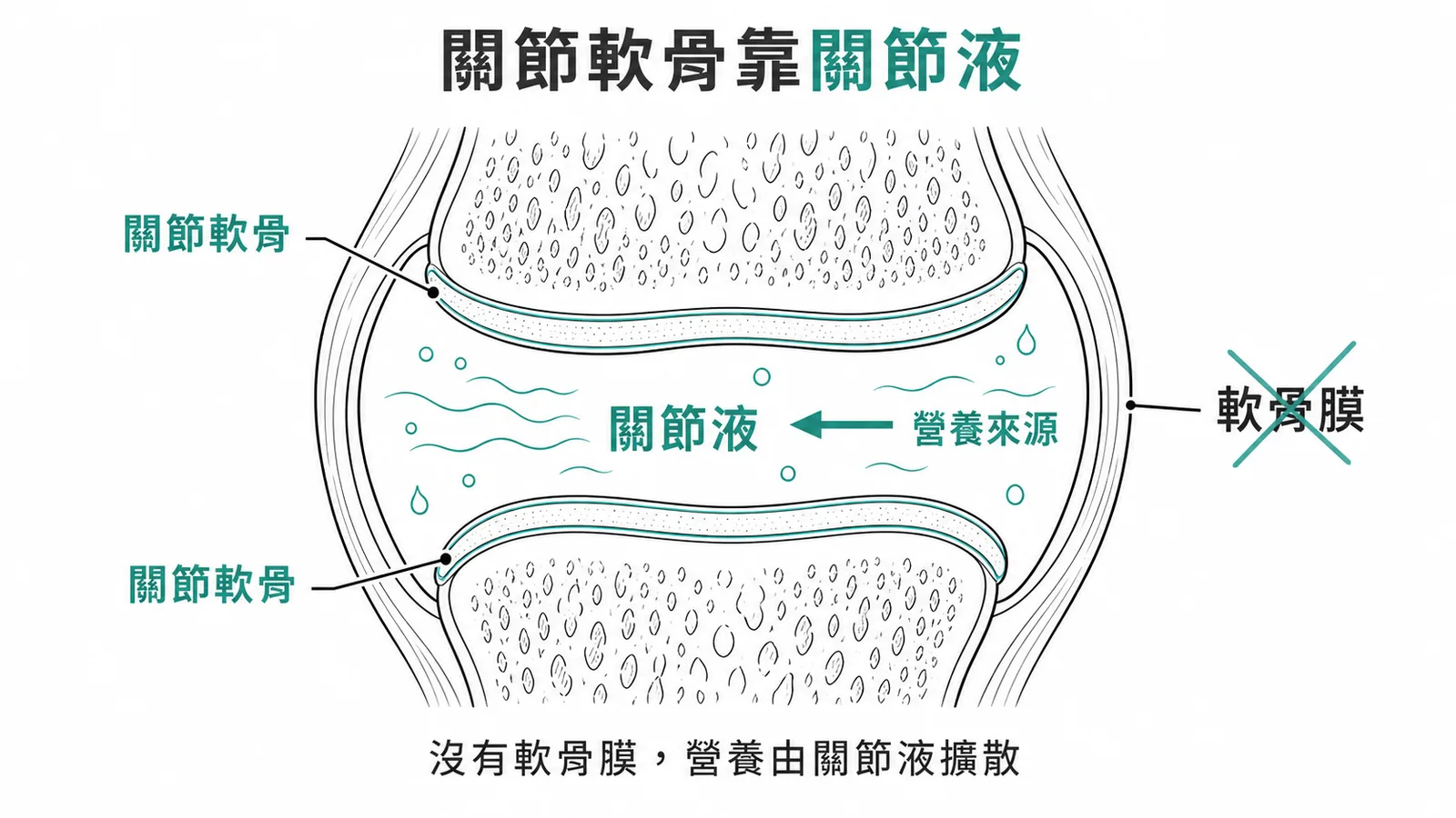 關節軟骨無軟骨膜,營養來自關節液