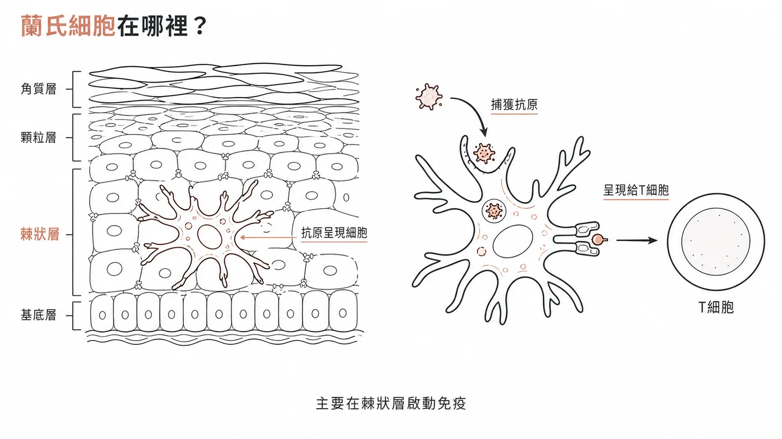 蘭氏細胞是表皮棘狀層的抗原呈現細胞