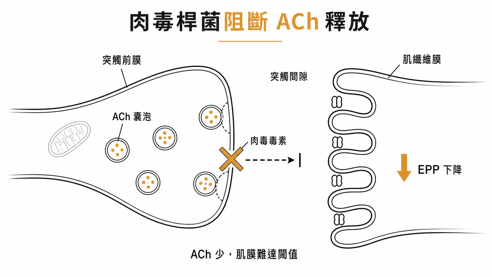 肉毒桿菌毒素阻斷乙醯膽鹼釋放導致終板電位下降
