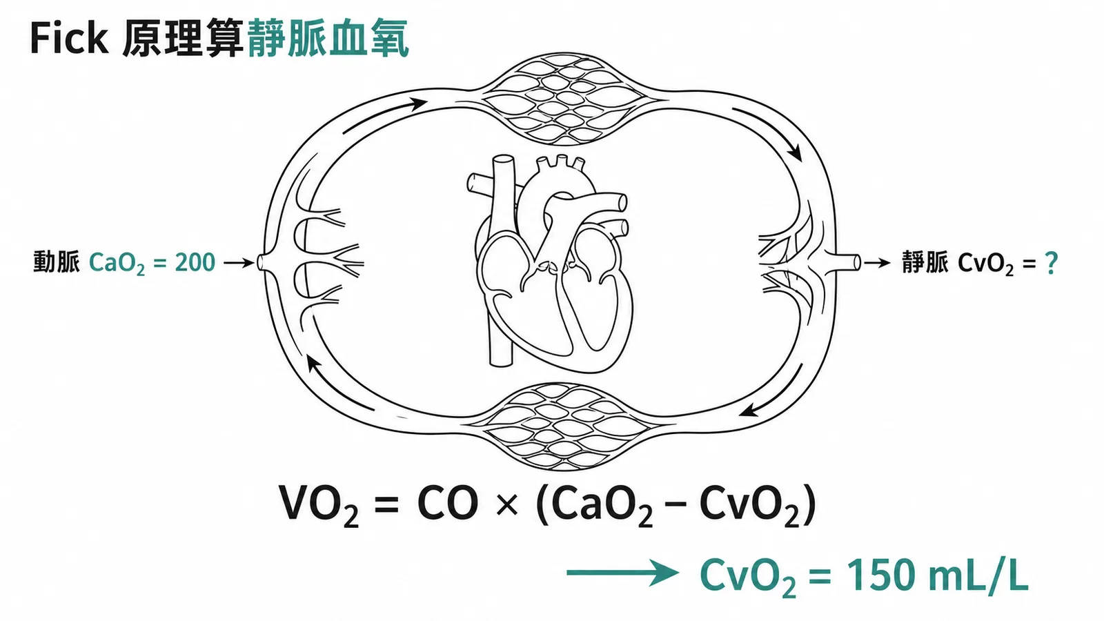 Fick 原理計算靜脈血氧濃度:VO₂ = CO × (CaO₂ − CvO₂)