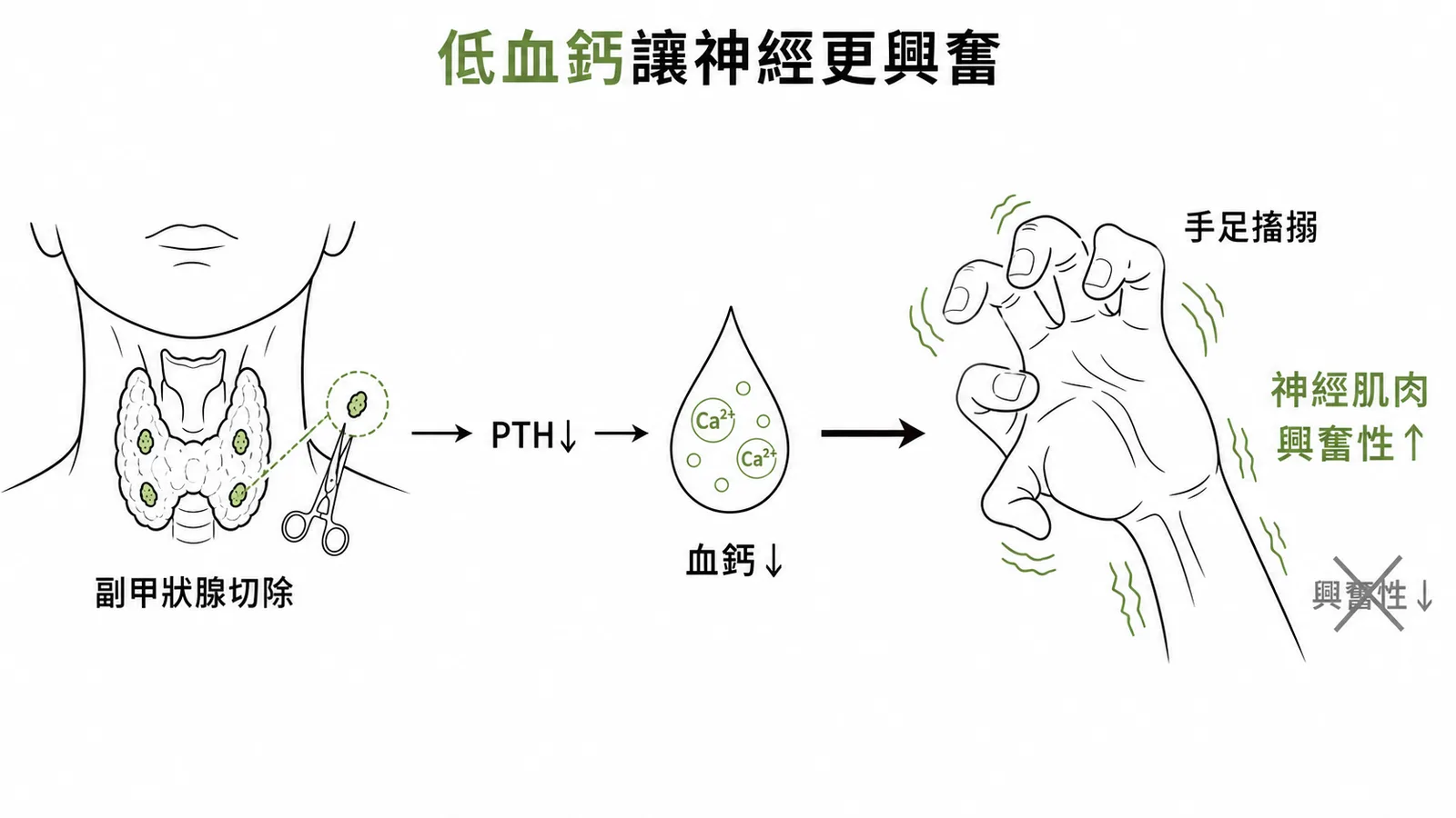 副甲狀腺切除導致低血鈣、神經肌肉興奮性升高的因果鏈