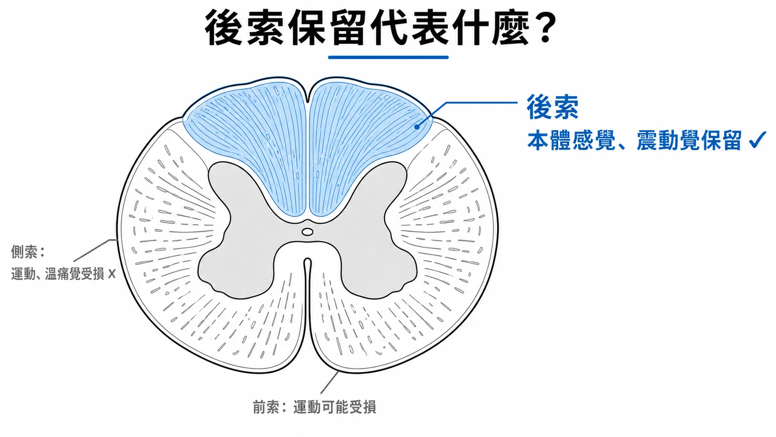 脊髓橫切面後索傳遞本體感覺與震動覺示意圖