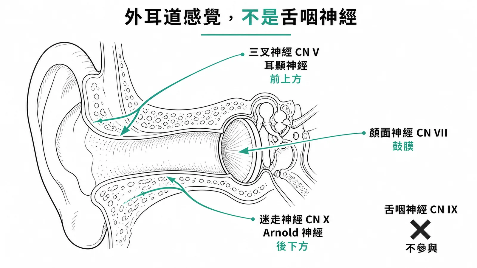外耳道感覺神經支配示意圖：三叉、顏面、迷走神經負責，舌咽神經不參與