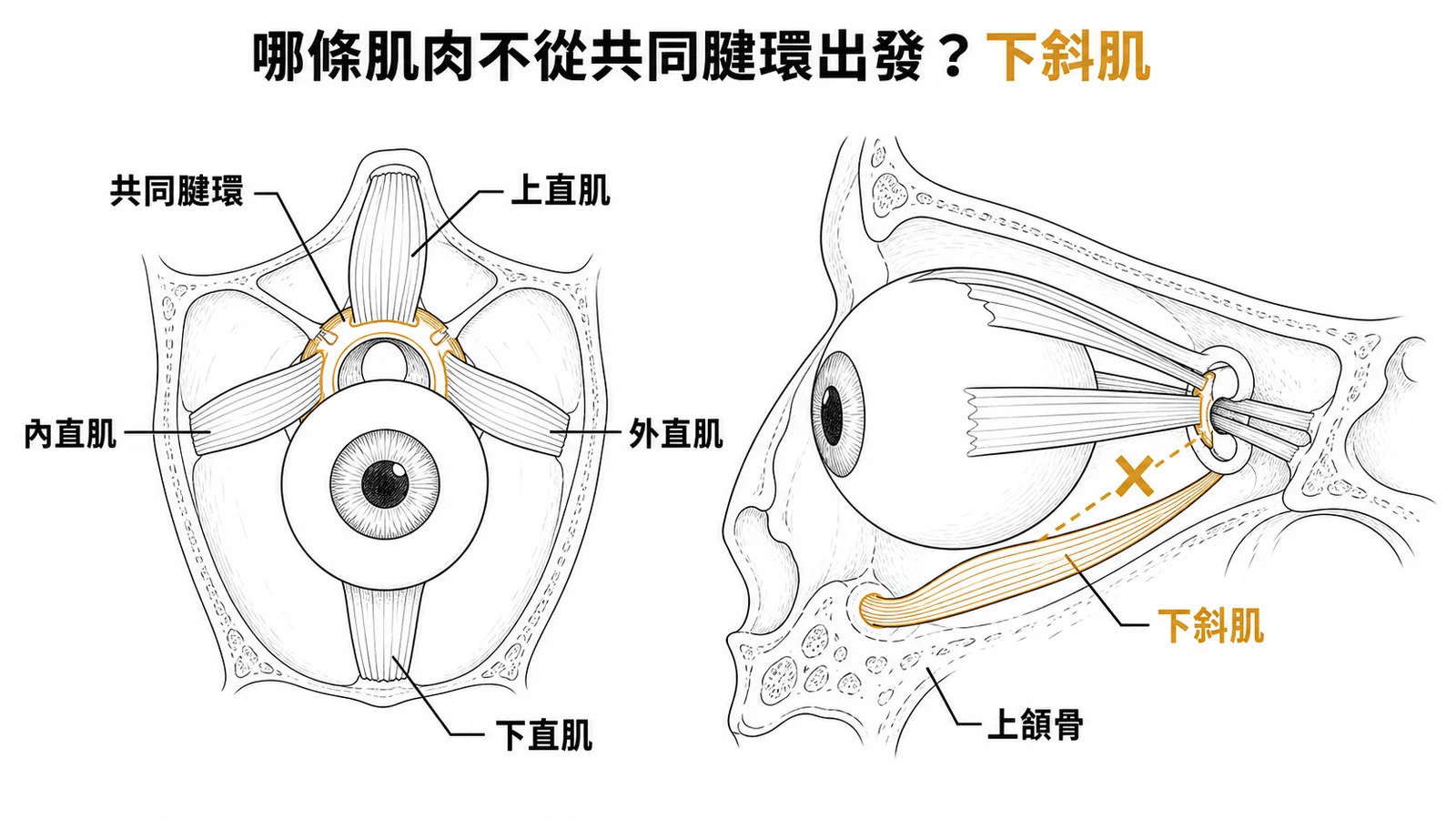 眼外肌起點:下斜肌不從共同腱環出發