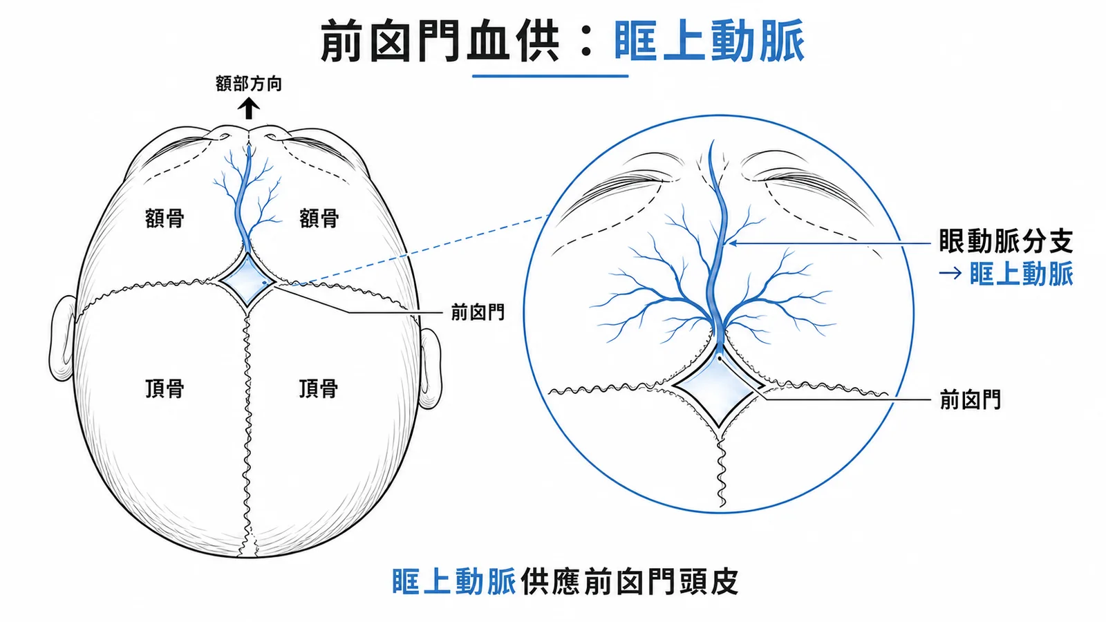 前囟門頭皮血供來自眶上動脈