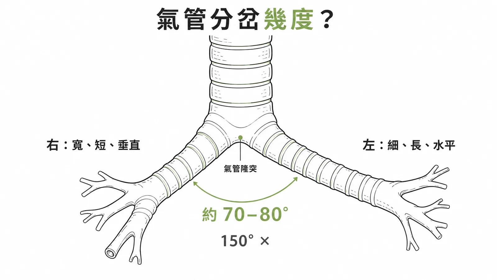 氣管分岔角度約70-80度示意圖,右主支氣管寬短垂直、左主支氣管細長水平