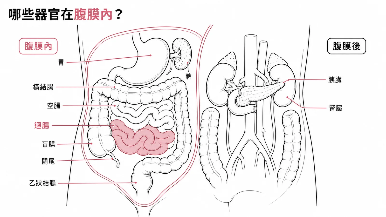 腹膜內器官與腹膜後器官分類示意圖，迴腸屬腹膜內器官