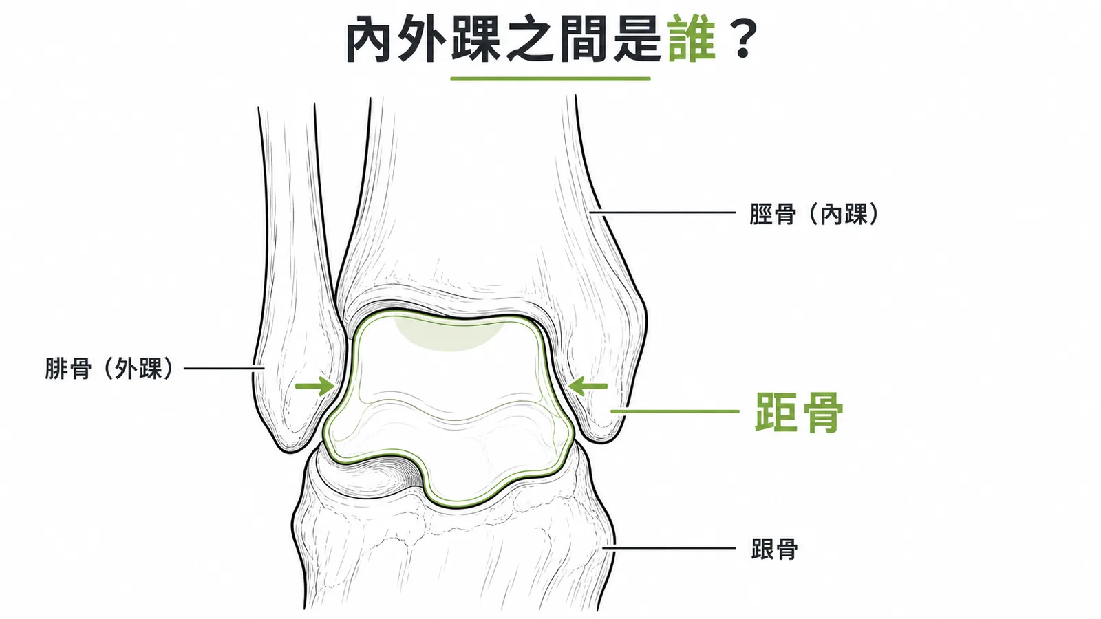 距骨被夾在內踝與外踝之間的踝關節正面示意