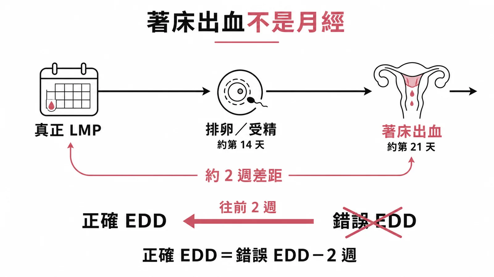 著床出血與預產期推算時間線:真正LMP到著床出血約2週差距,正確EDD需往前推2週