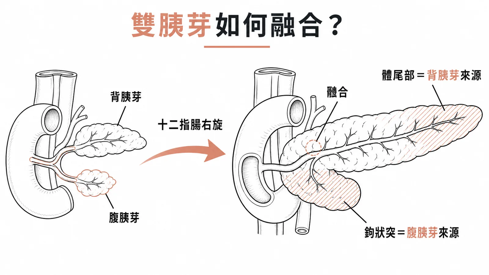 胰臟雙胰芽發育:十二指腸右旋後腹胰芽與背胰芽融合,腹胰芽形成鉤狀突