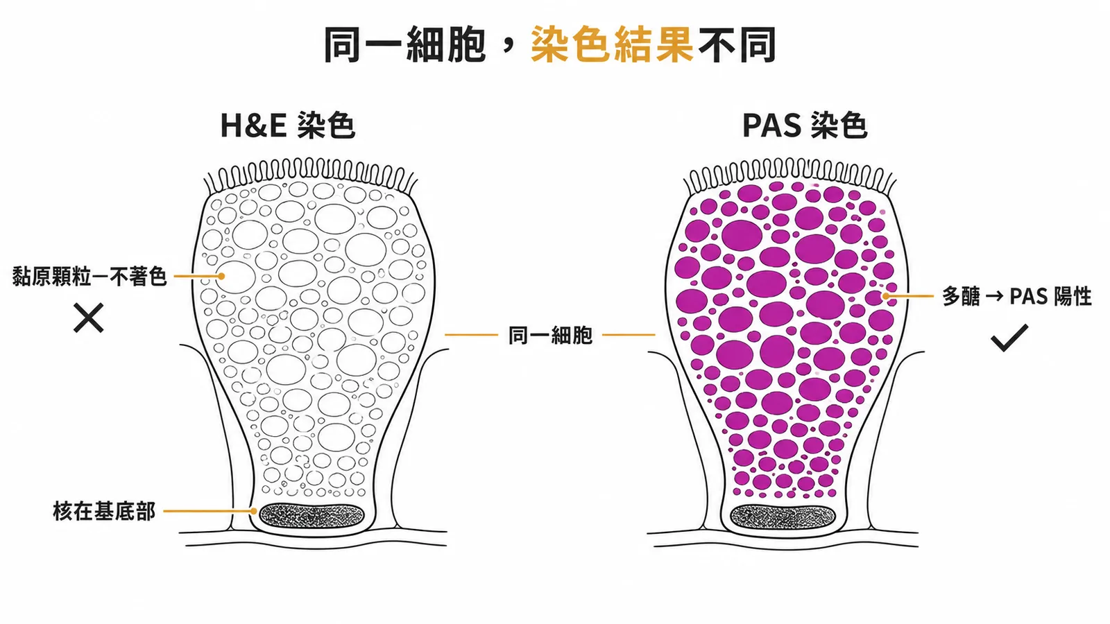 黏液細胞染色對比:H&E不著色vs PAS陽性(多醣呈紫紅色)