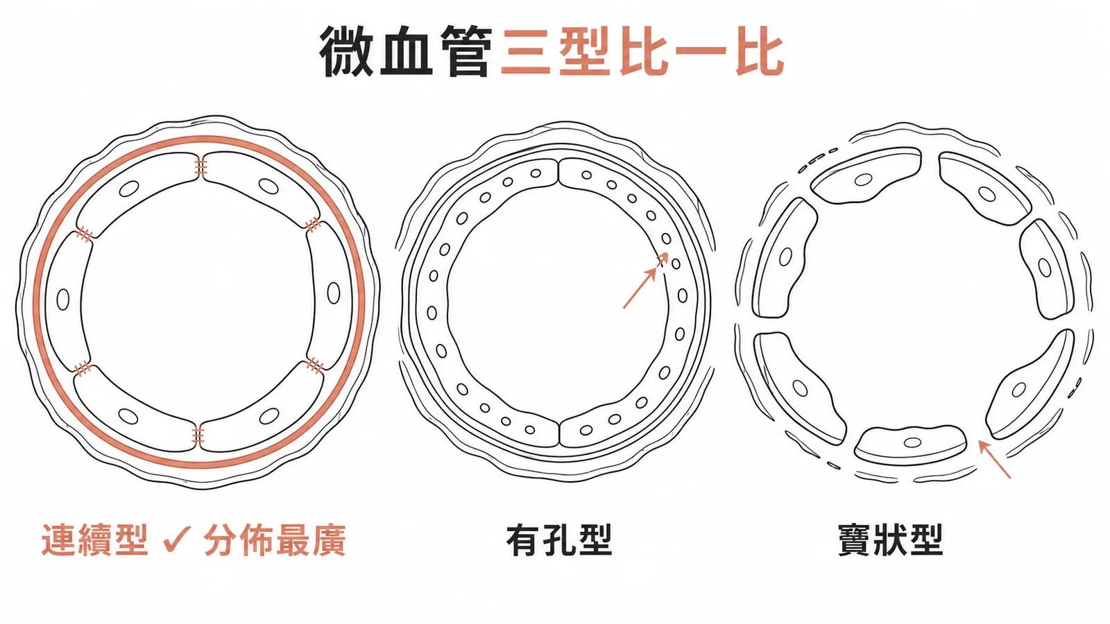 微血管三型比較:連續型(分佈最廣、緊密連接)、有孔型、竇狀型
