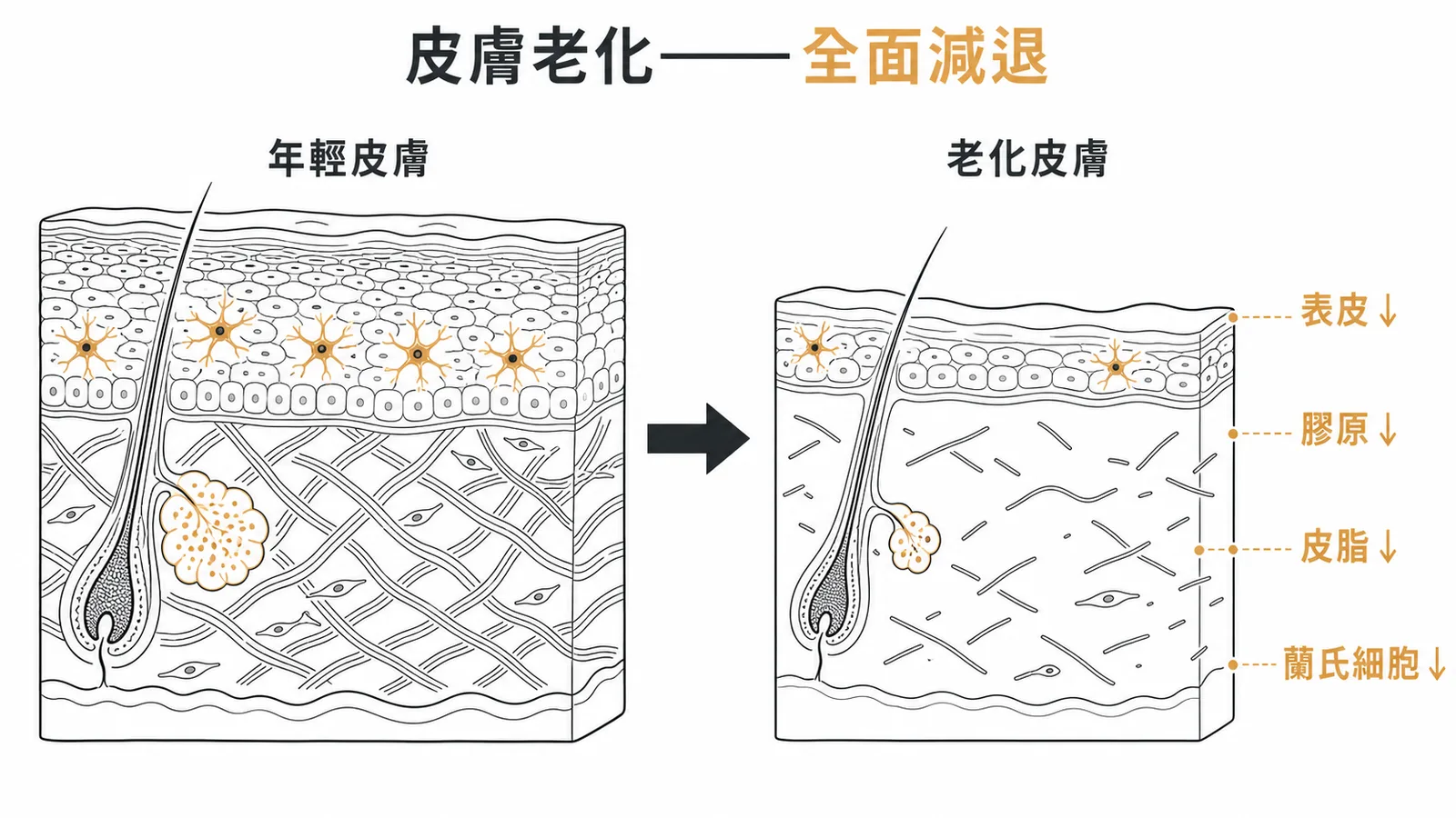 皮膚老化對比：年輕皮膚到老化皮膚，表皮、膠原、皮脂、蘭氏細胞全面減退