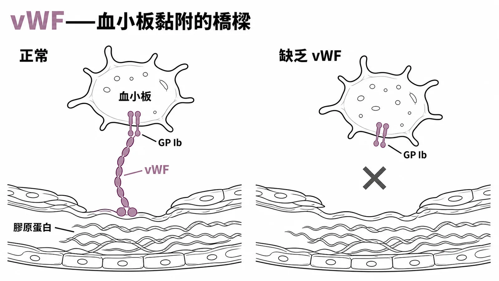 vWF橋接膠原蛋白與血小板GP Ib缺乏則黏附失敗