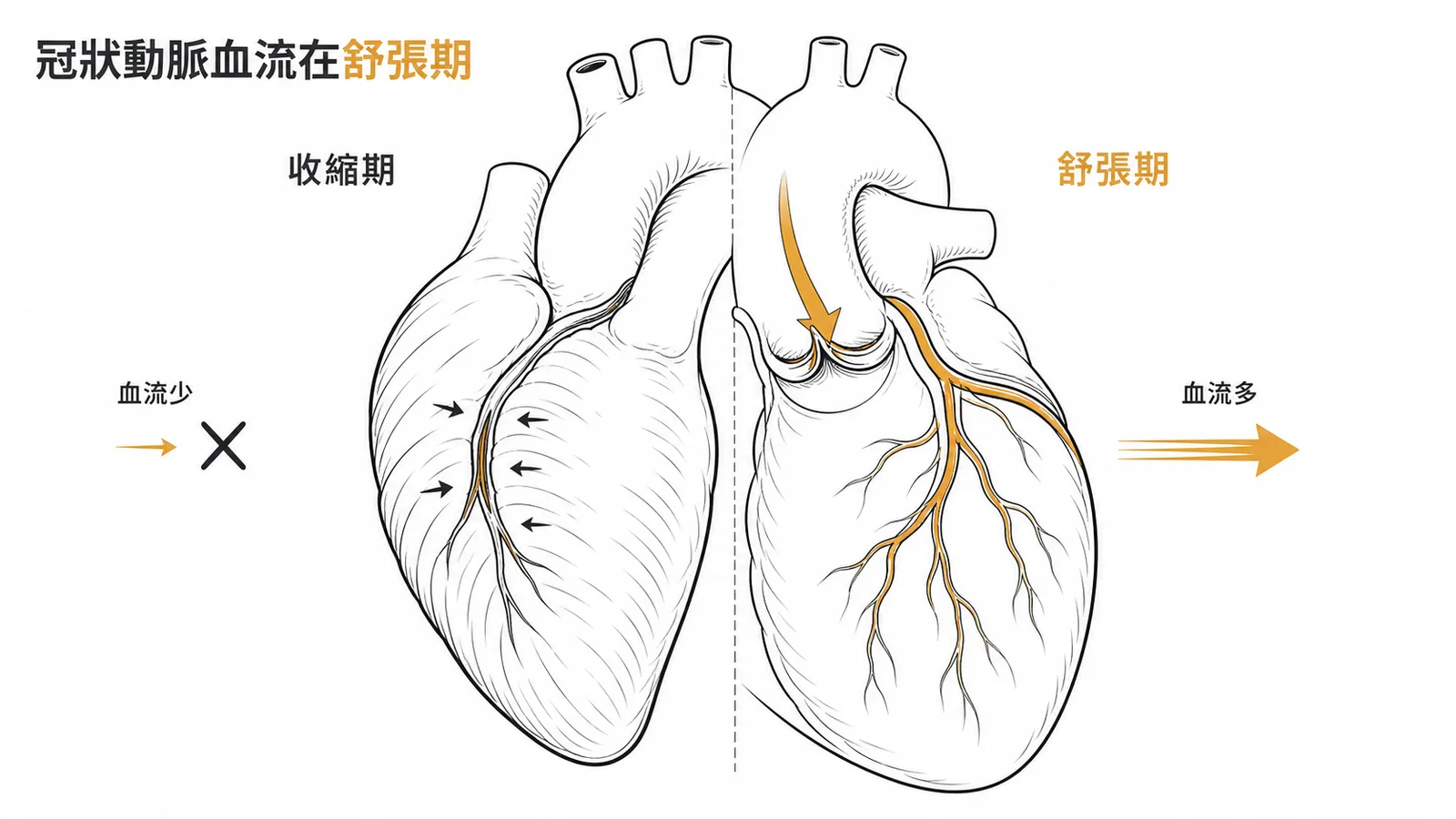 收縮期心肌壓迫冠狀動脈血流少舒張期放鬆血流多