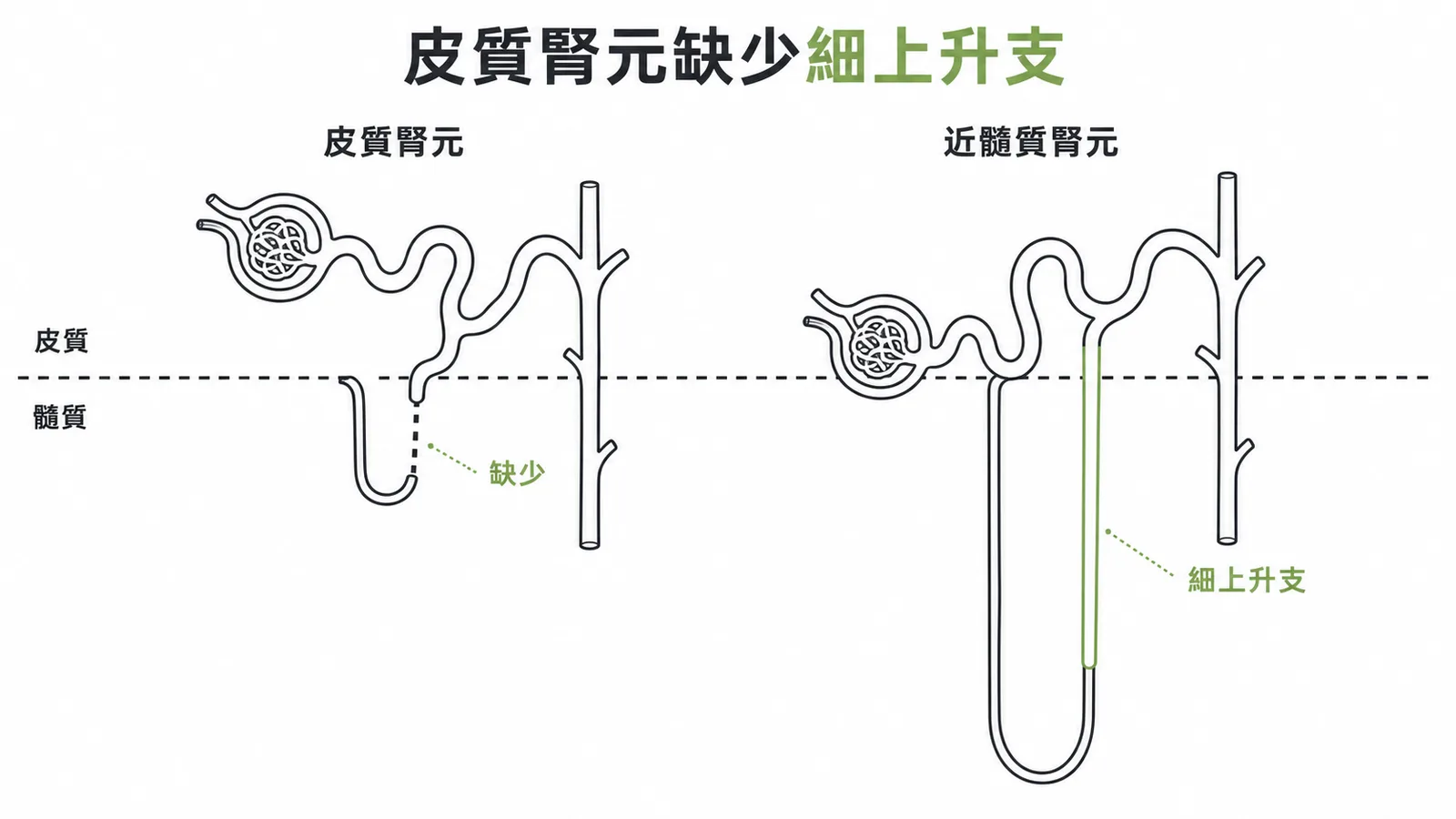 皮質腎元與近髓質腎元對比,皮質腎元亨利氏環短且缺少細上升支