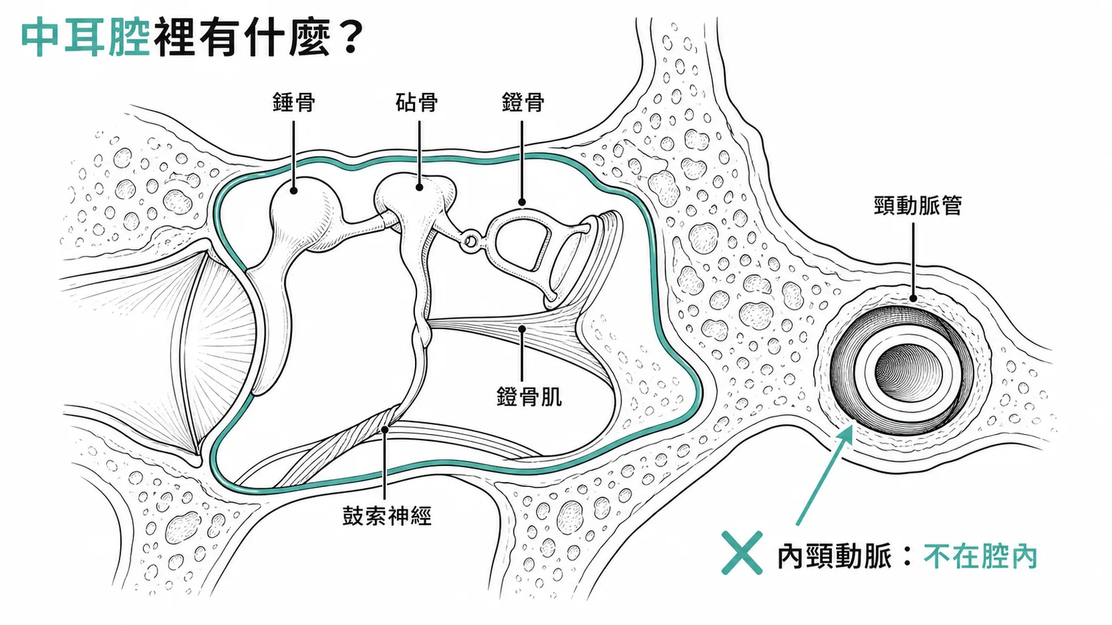 中耳腔含聽小骨鐙骨肌鼓索神經而內頸動脈在頸動脈管中不在腔內