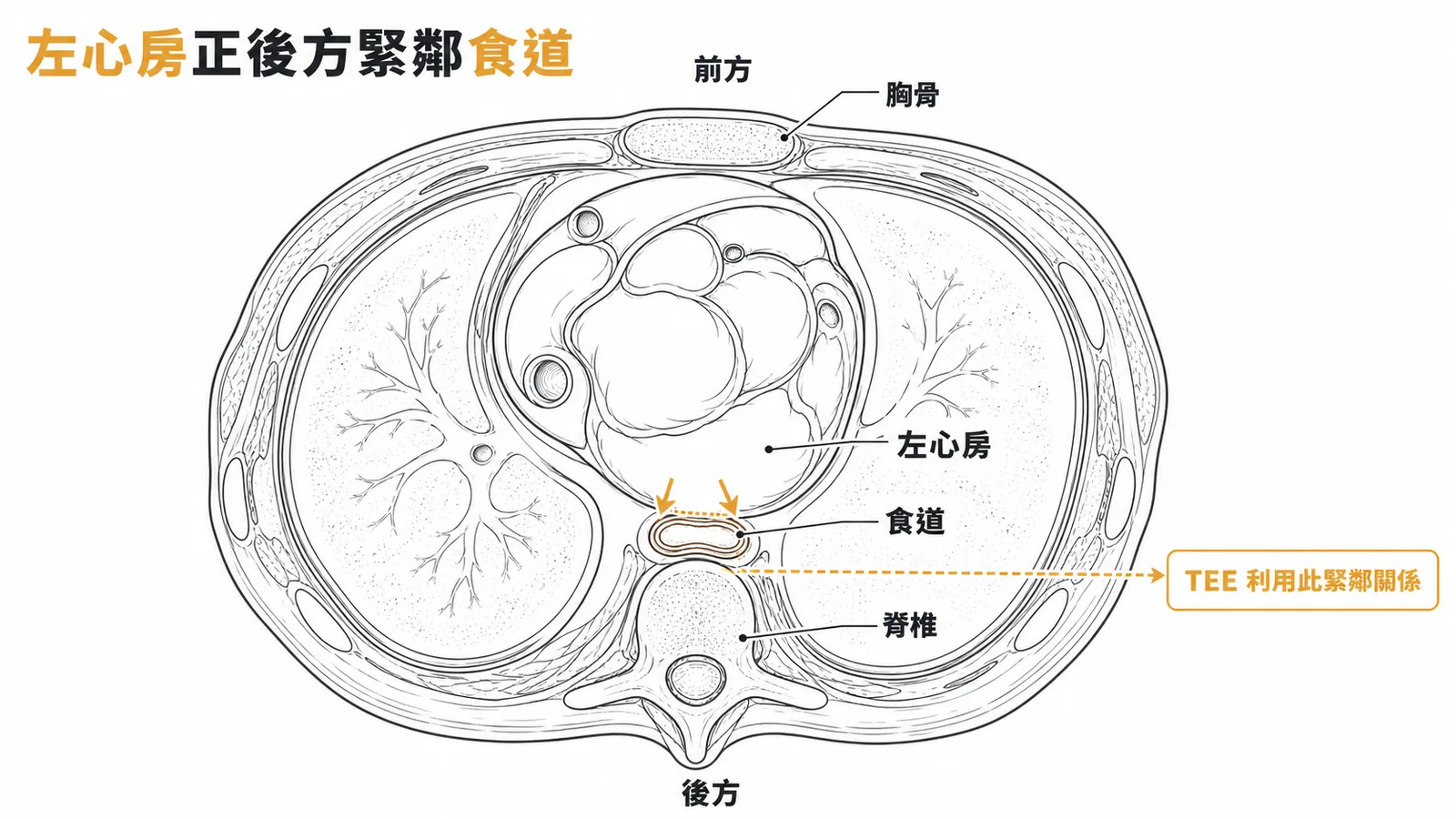 胸腔橫斷面顯示左心房正後方緊鄰食道的位置關係