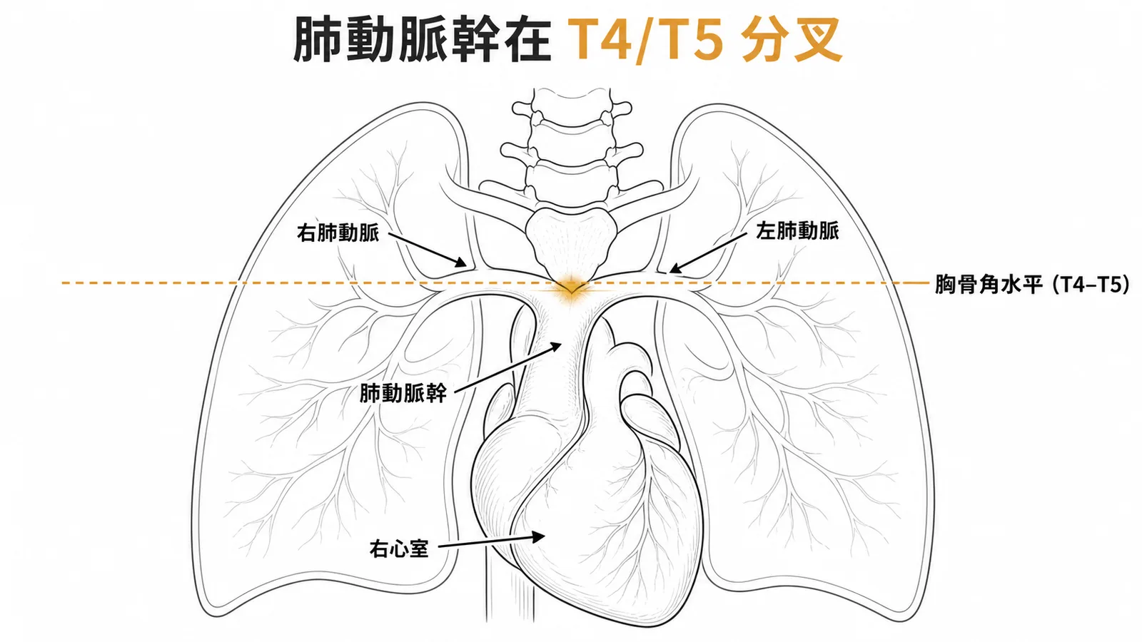 肺動脈幹從右心室發出在T4/T5胸骨角水平分叉成左右肺動脈