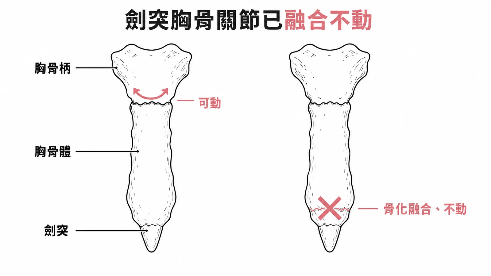胸骨正面圖對比柄胸關節可動與劍突胸骨關節骨化融合不動