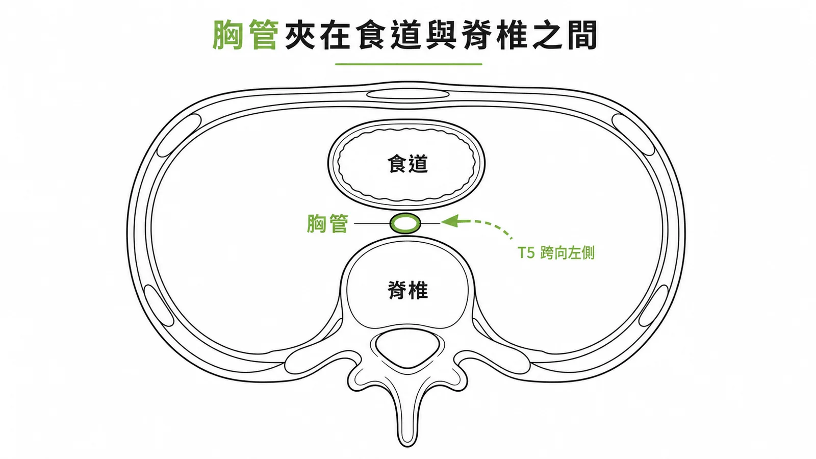 後縱隔橫斷面顯示胸管位於食道後方脊椎前方