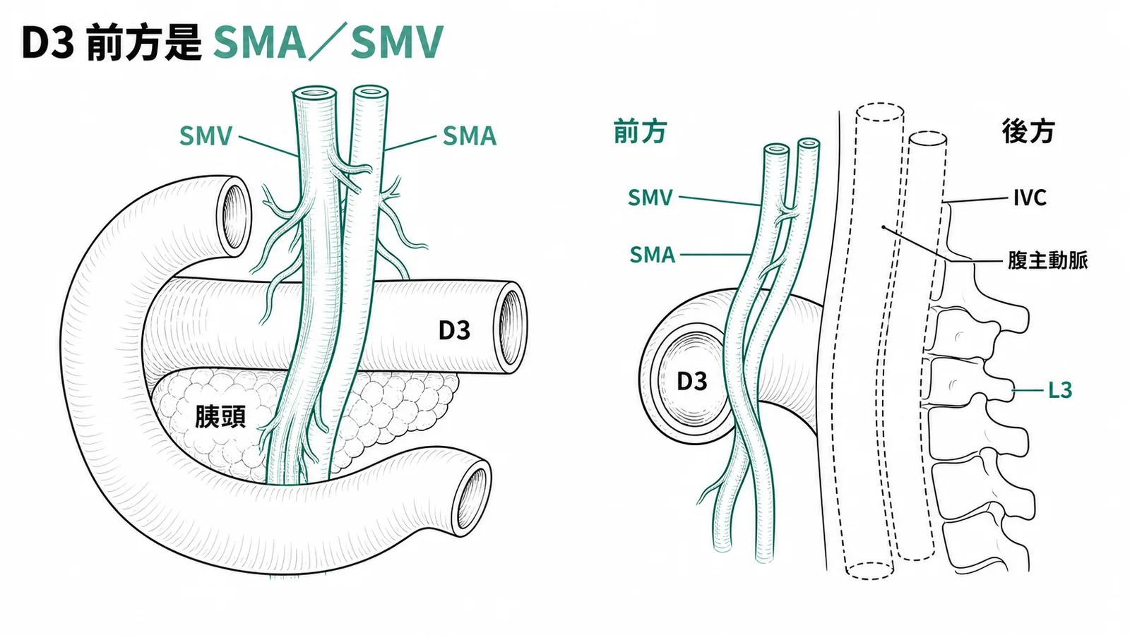 十二指腸D3水平段前方有SMA和SMV跨越後方為IVC和腹主動脈