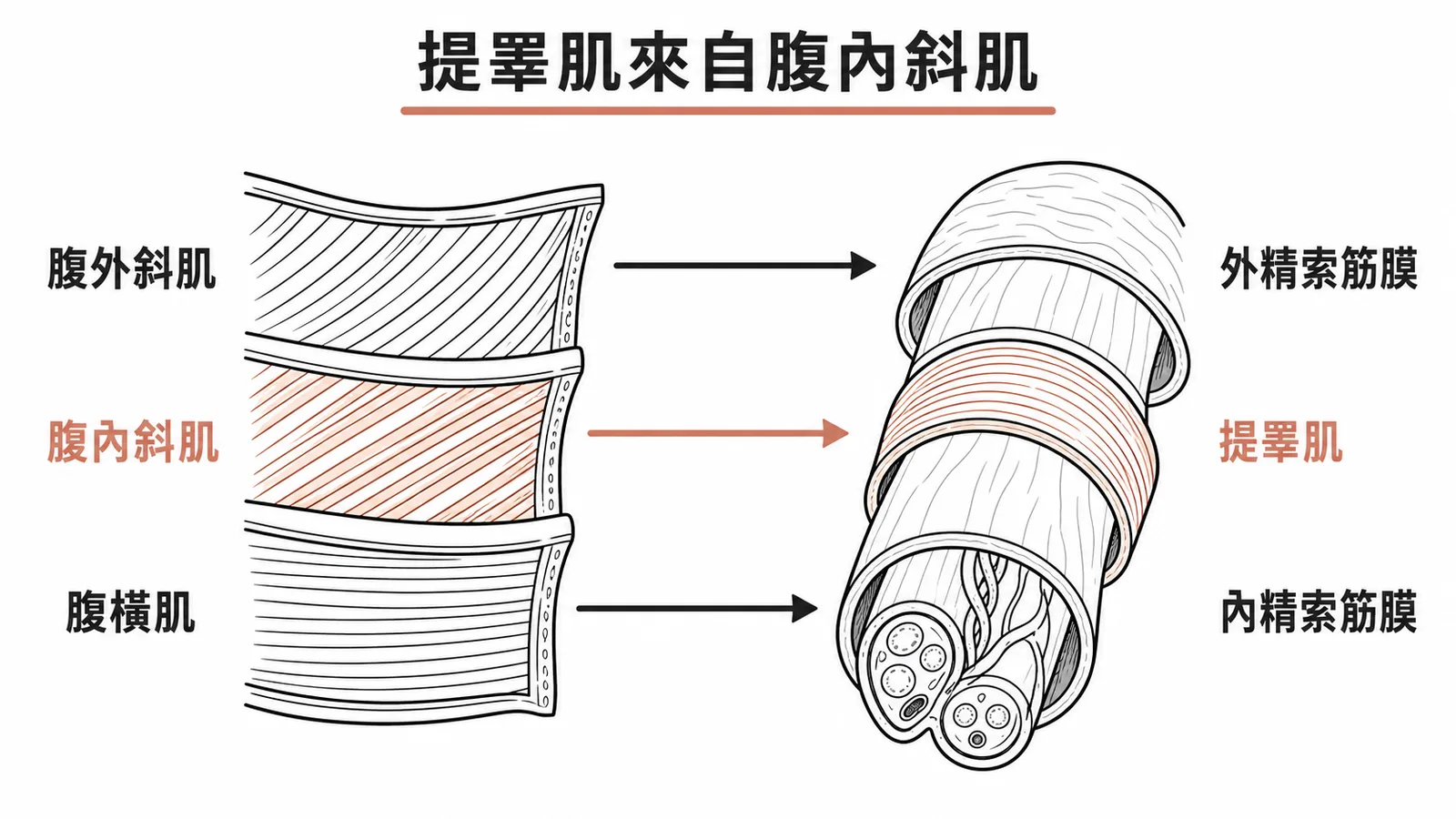 腹壁三層肌肉對應精索三層被膜：腹內斜肌延伸為提睪肌