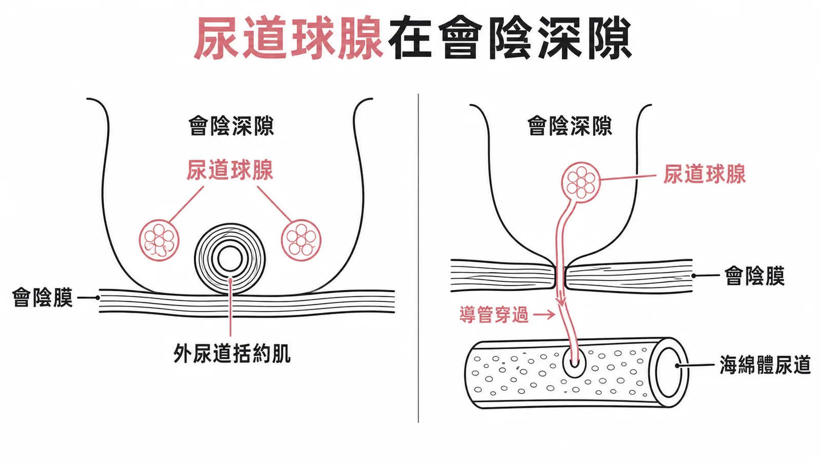 尿道球腺位於會陰深隙，導管穿過會陰膜開口於海綿體尿道