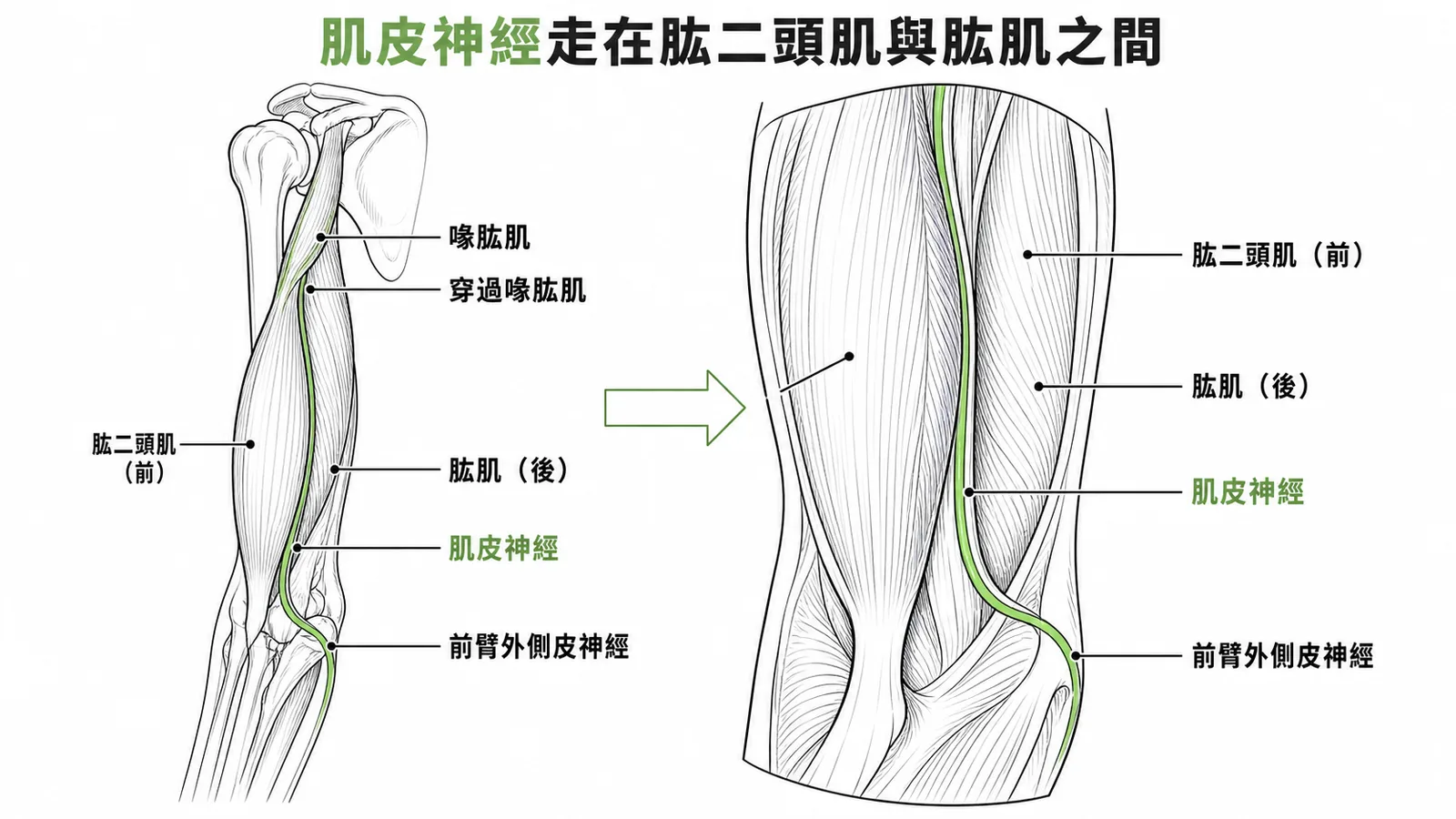 肌皮神經穿過喙肱肌後走在肱二頭肌與肱肌之間