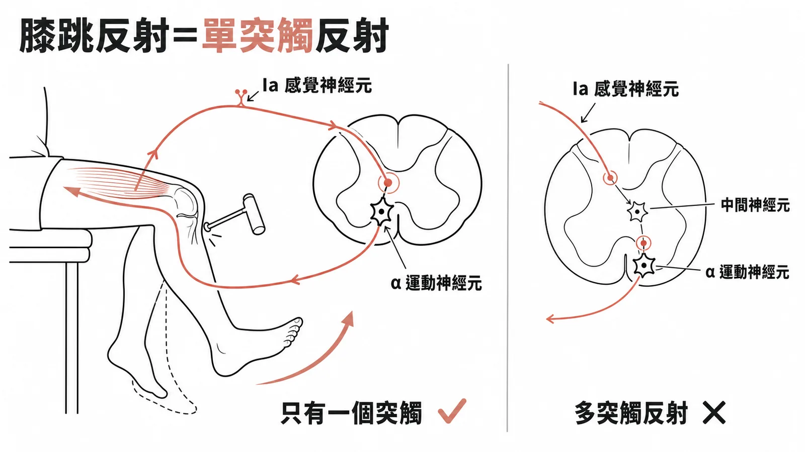 膝跳反射是典型的單突觸反射：Ia感覺神經元直接連接α運動神經元