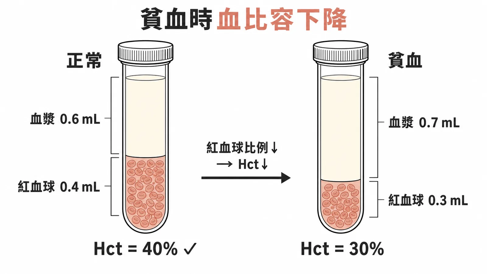正常血比容40%與貧血時血比容降至30%的離心管對照圖