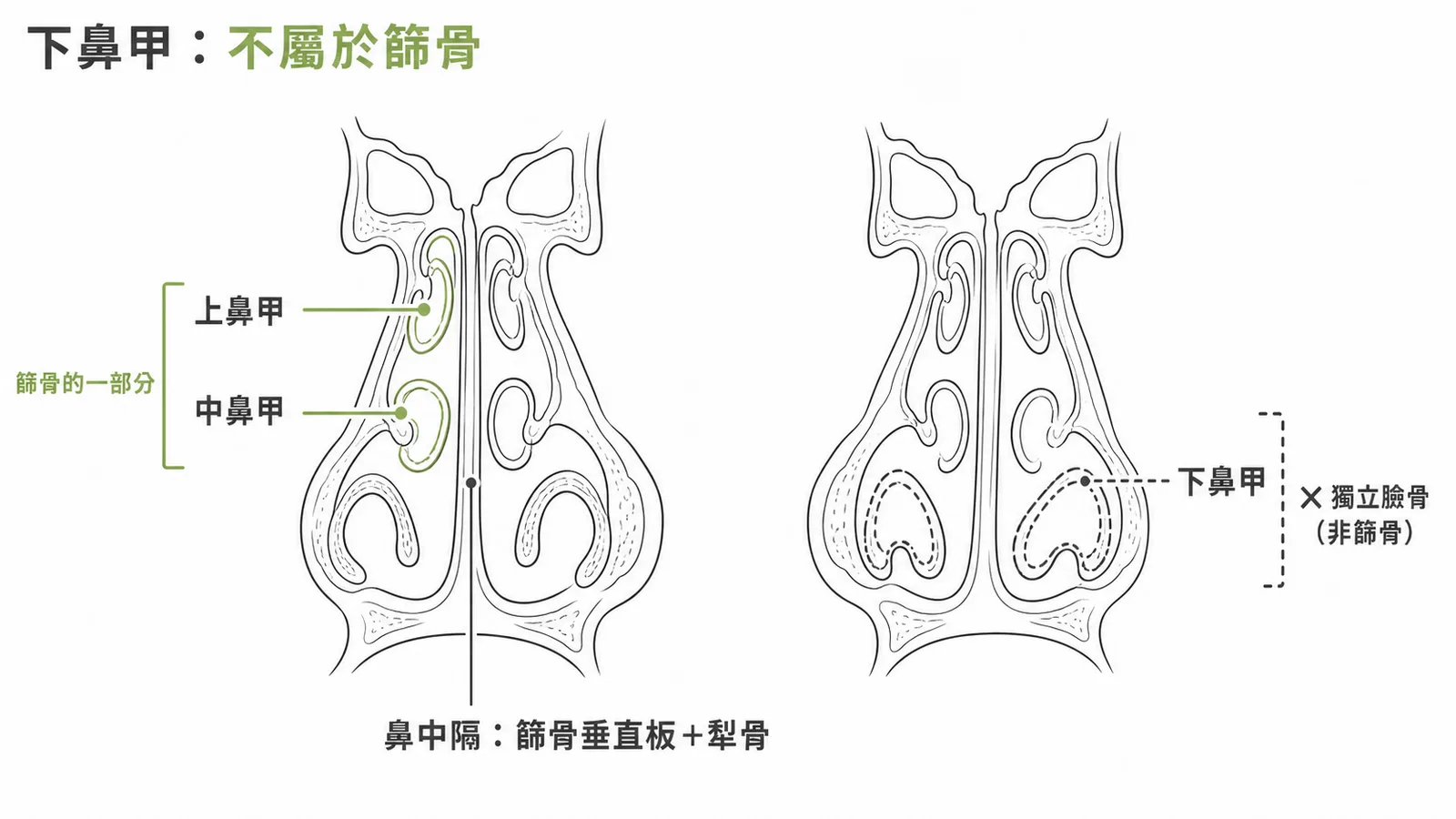 鼻腔截面:上中鼻甲屬篩骨,下鼻甲為獨立臉骨